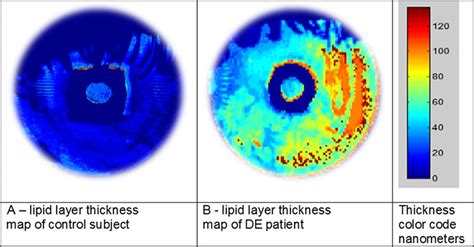 thickness of lipid film